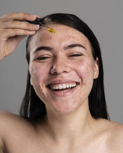 面部女人用一种特殊的油来祛痘毛孔健康痤疮