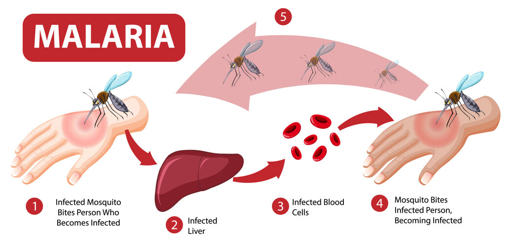 血液疟疾症状信息图昆虫意识昆虫